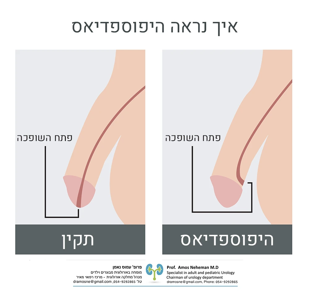 איך נראה היפוספדיאס